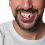 Missing Teeth Replacement