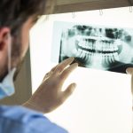 How Often Should You Visit The Dentist